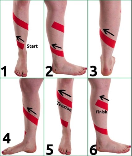 Shin Splint Taping A Guide To Strapping Your Shins To Help Shin Splints