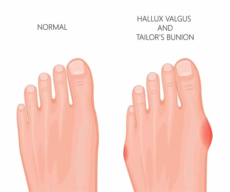 Children's Podiatrist Sydney